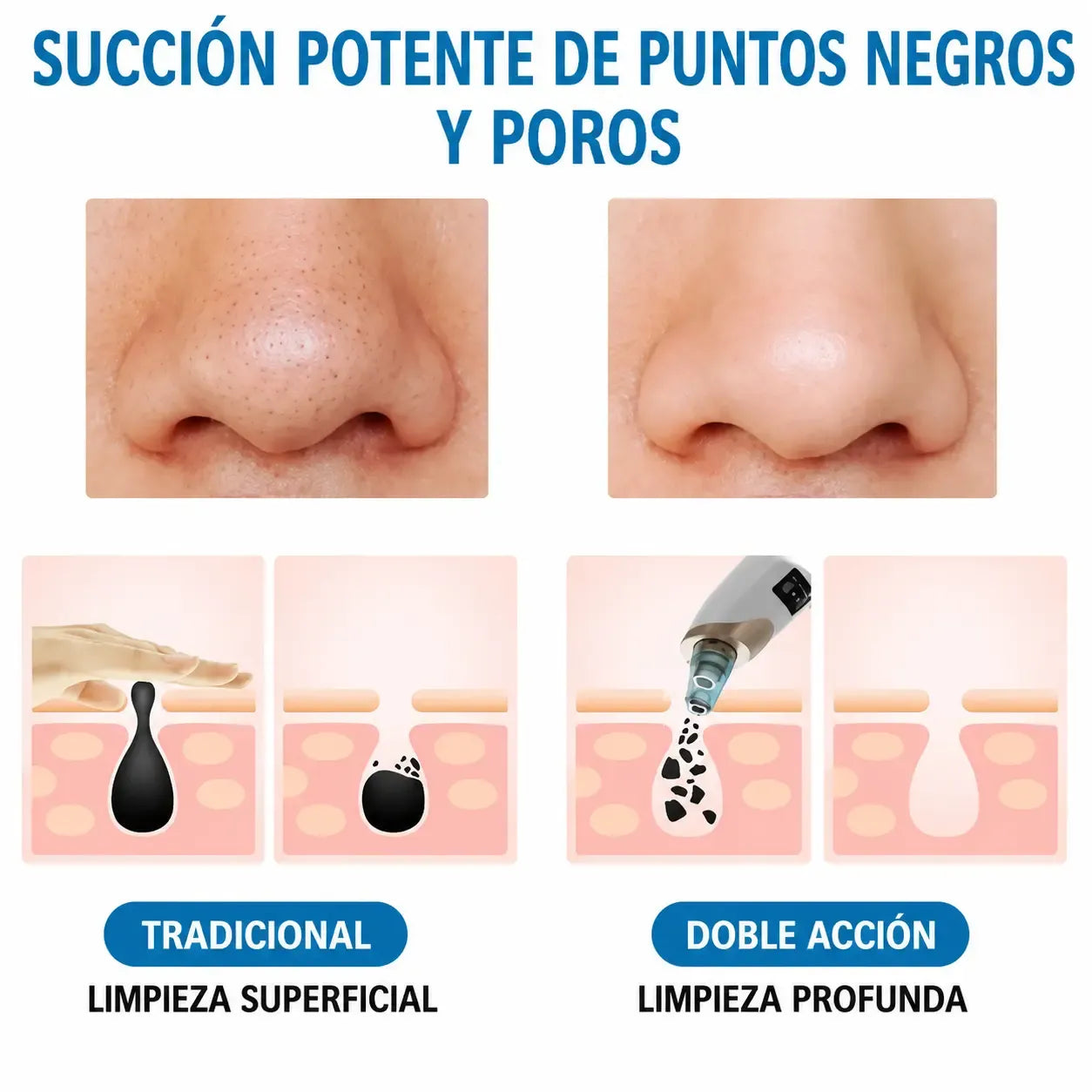 Limpiador de Puntos Negros BellaCleaner®