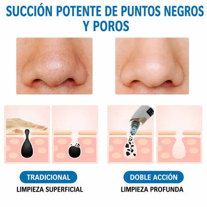 Limpiador de Puntos Negros BellaCleaner®